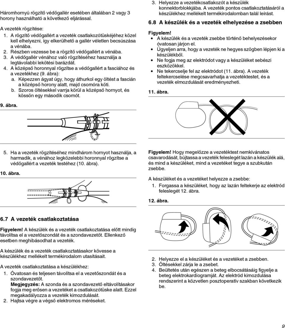 A védőgallér vénához való rögzítéséhez használja a legtávolabbi lekötési barázdát. 4. A középső horonnyal rögzítse a védőgallért a fasciához és a vezetékhez (9. ábra): a.