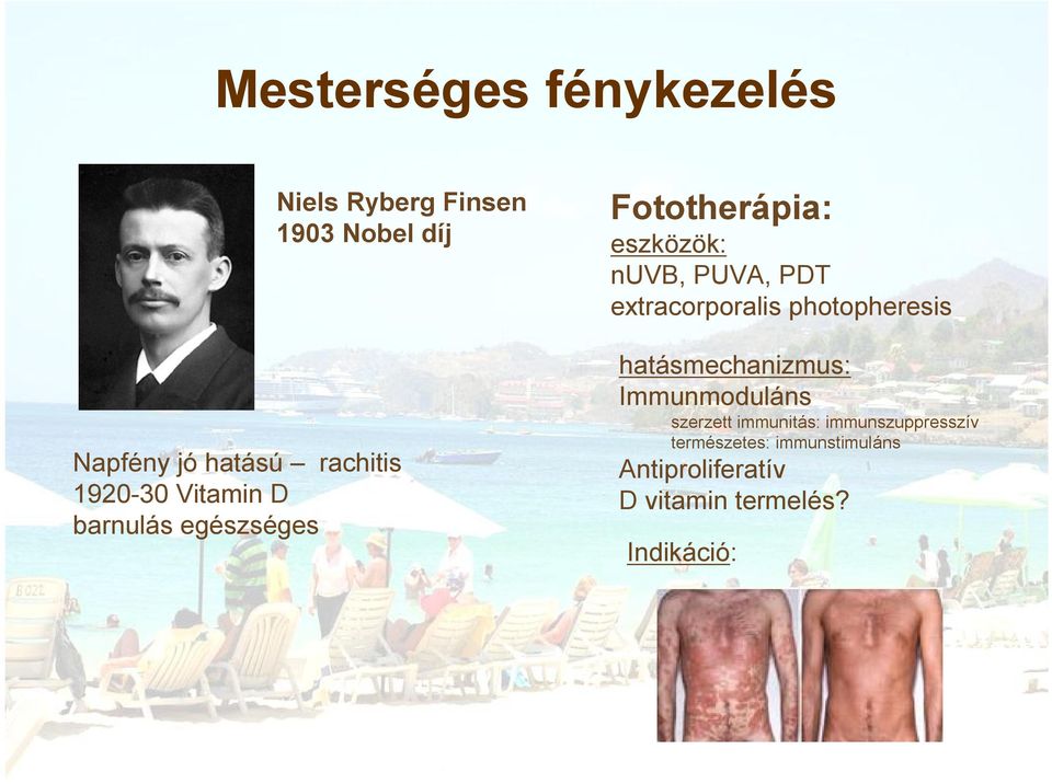 PDT extracorporalis photopheresis hatásmechanizmus: Immunmoduláns szerzett