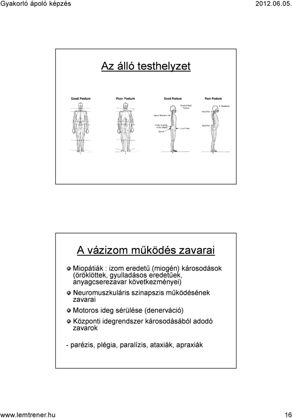 Neuromuszkuláris szinapszis működésének zavarai Motoros ideg sérülése (denerváció)