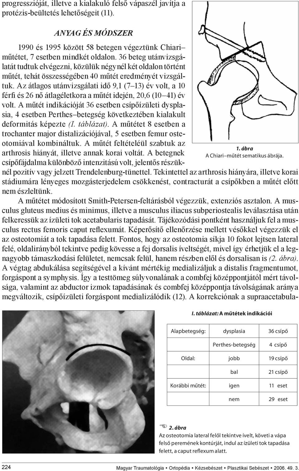 36 beteg utánvizsgálatát tudtuk elvégezni, közülük négynél két oldalon történt műtét, tehát összességében 40 műtét eredményét vizsgáltuk.