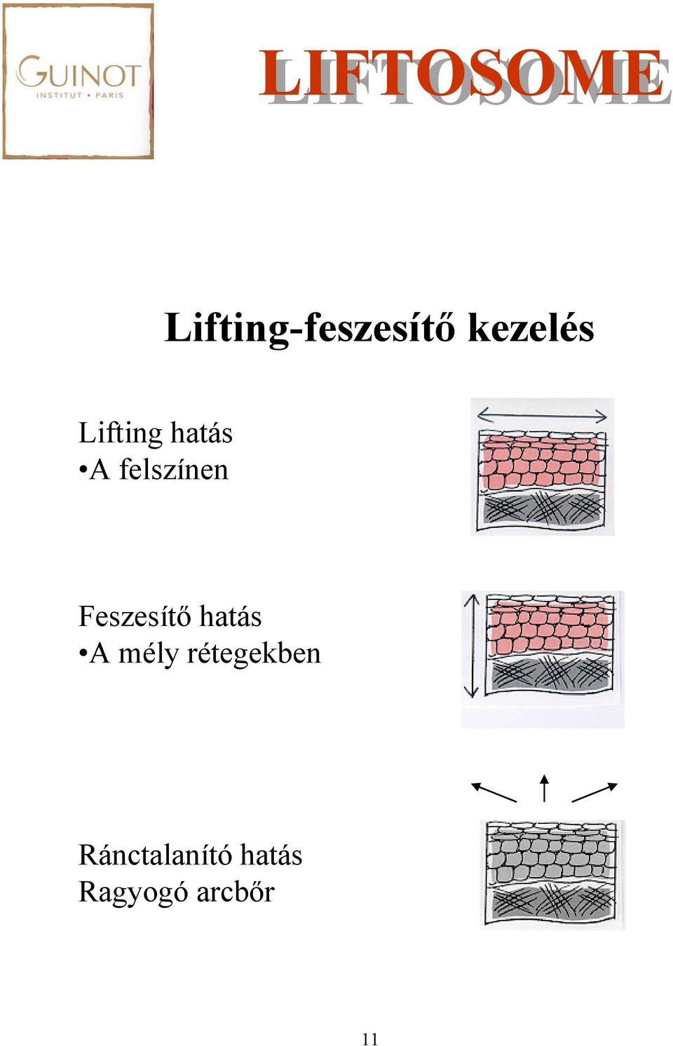 Feszesítő hatás A mély