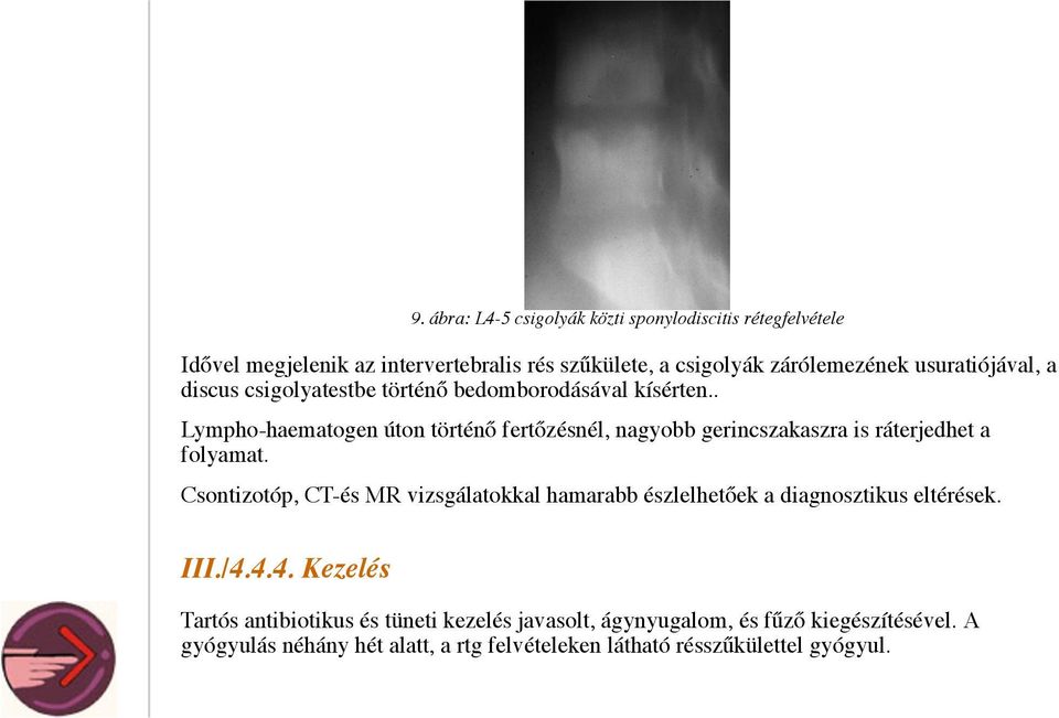 . Lympho-haematogen úton történő fertőzésnél, nagyobb gerincszakaszra is ráterjedhet a folyamat.