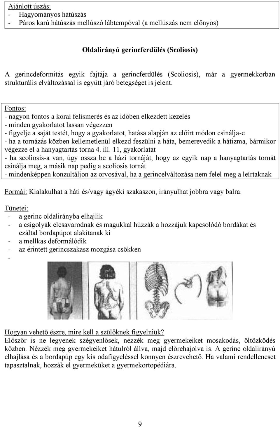A Marfan szindróma szövődményeként kialakuló gerincferdülés esetén, illetve  annak megelőzése érdekében alkalmazható gerinctorna - PDF Ingyenes letöltés
