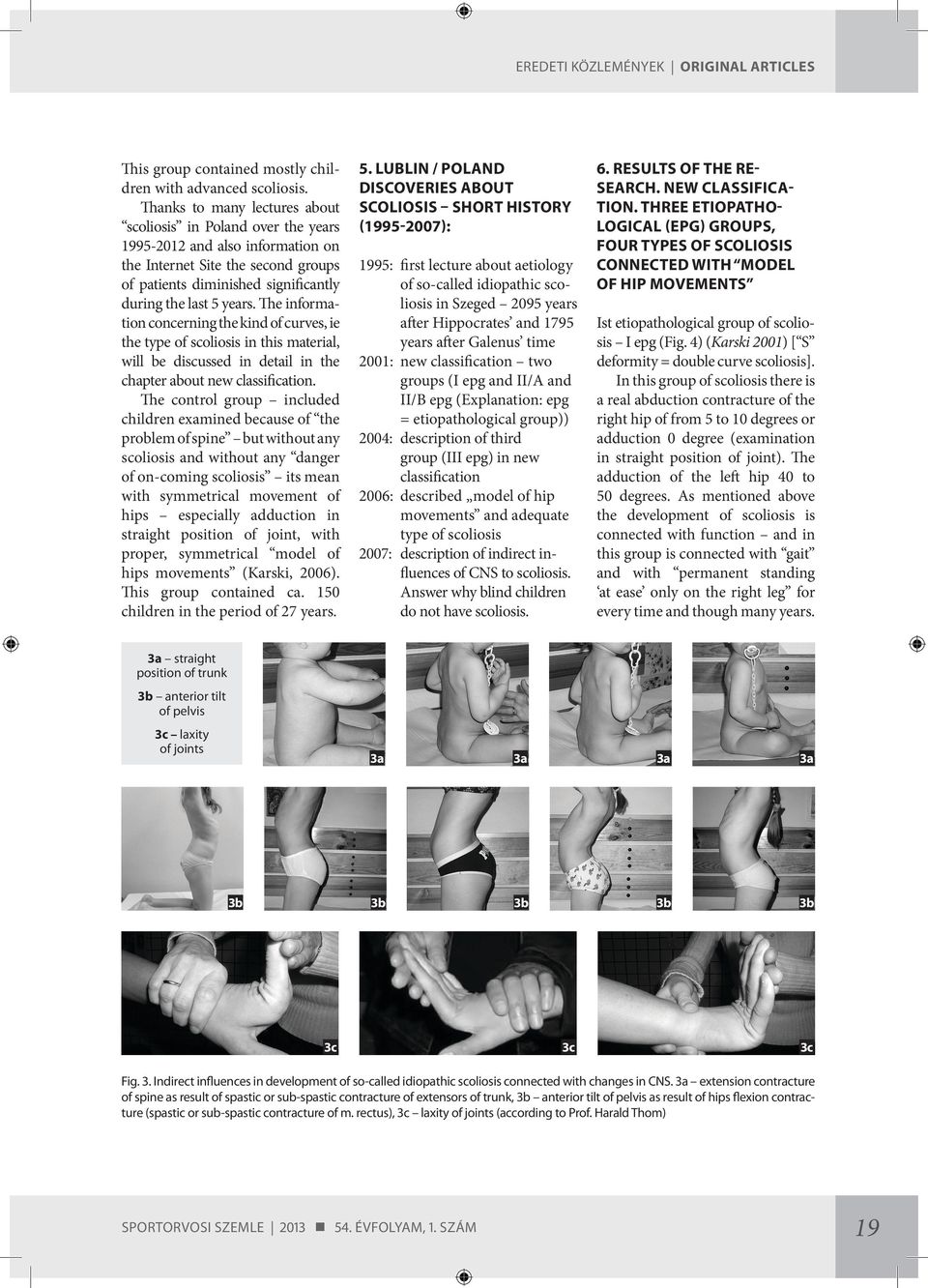 The in for ma tion concerning the kind of curves, ie the type of scoliosis in this material, will be discussed in detail in the chapter about new classification.