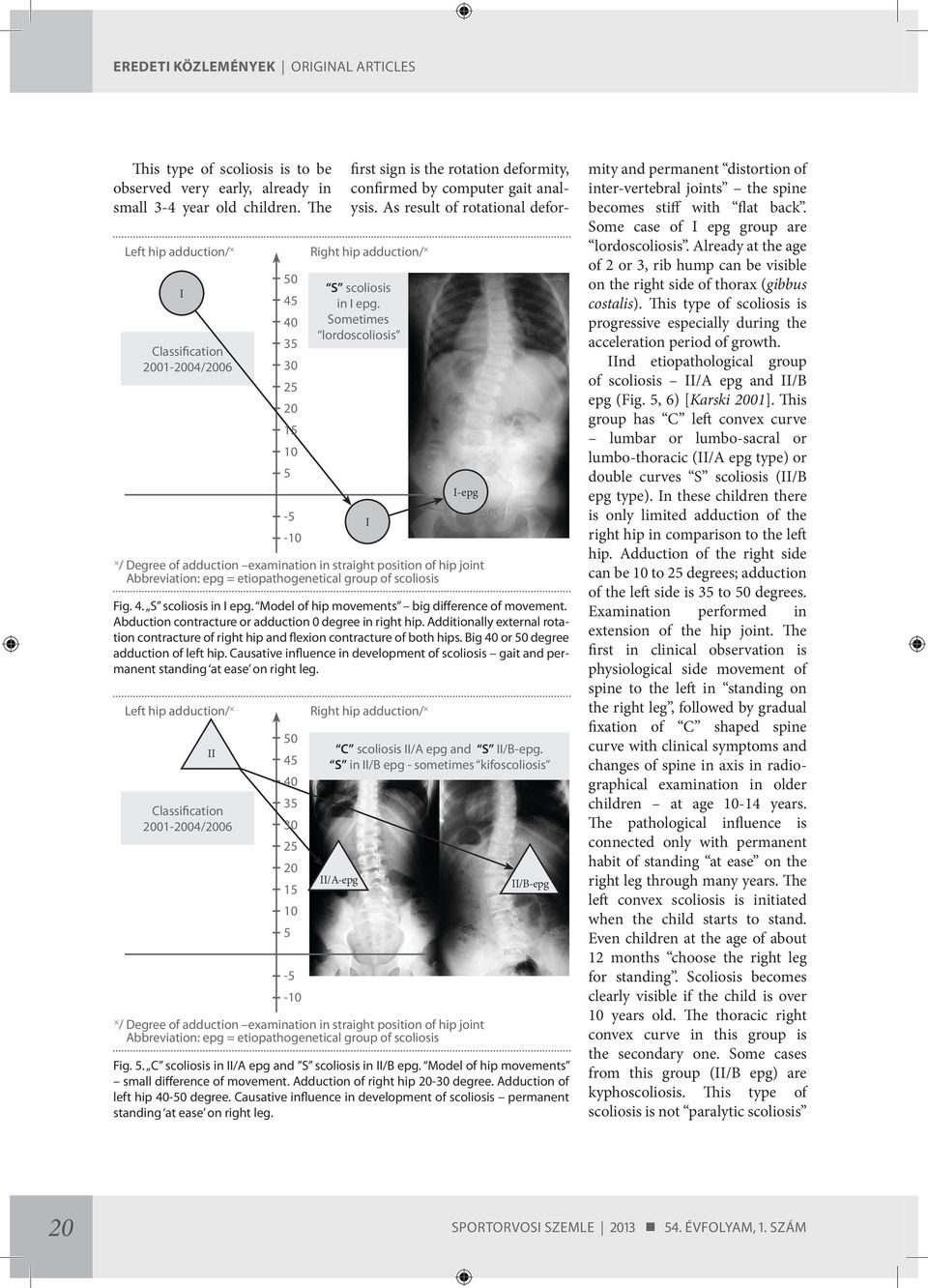 Sometimes lordoscoliosis I-epg / Degree of adduction examination in straight position of hip joint Abbreviation: epg = etiopathogenetical group of scoliosis Fig. 4. S scoliosis in I epg.