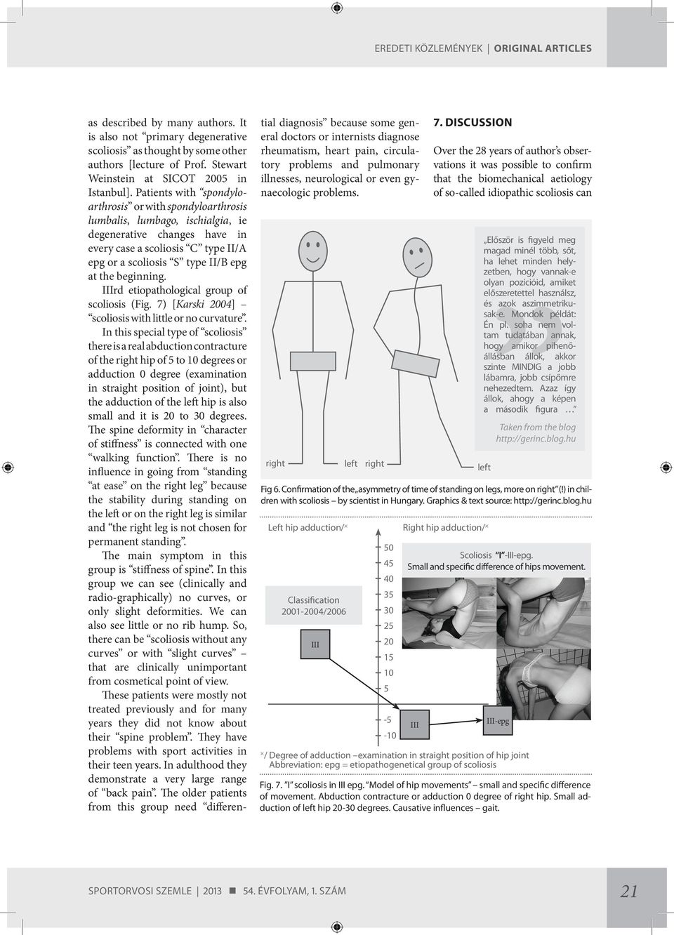 Patients with spondyloarthrosis or with spondyloarthrosis lumbalis, lumbago, ischialgia, ie degenerative changes have in every case a scoliosis C type II/A epg or a scoliosis S type II/B epg at the