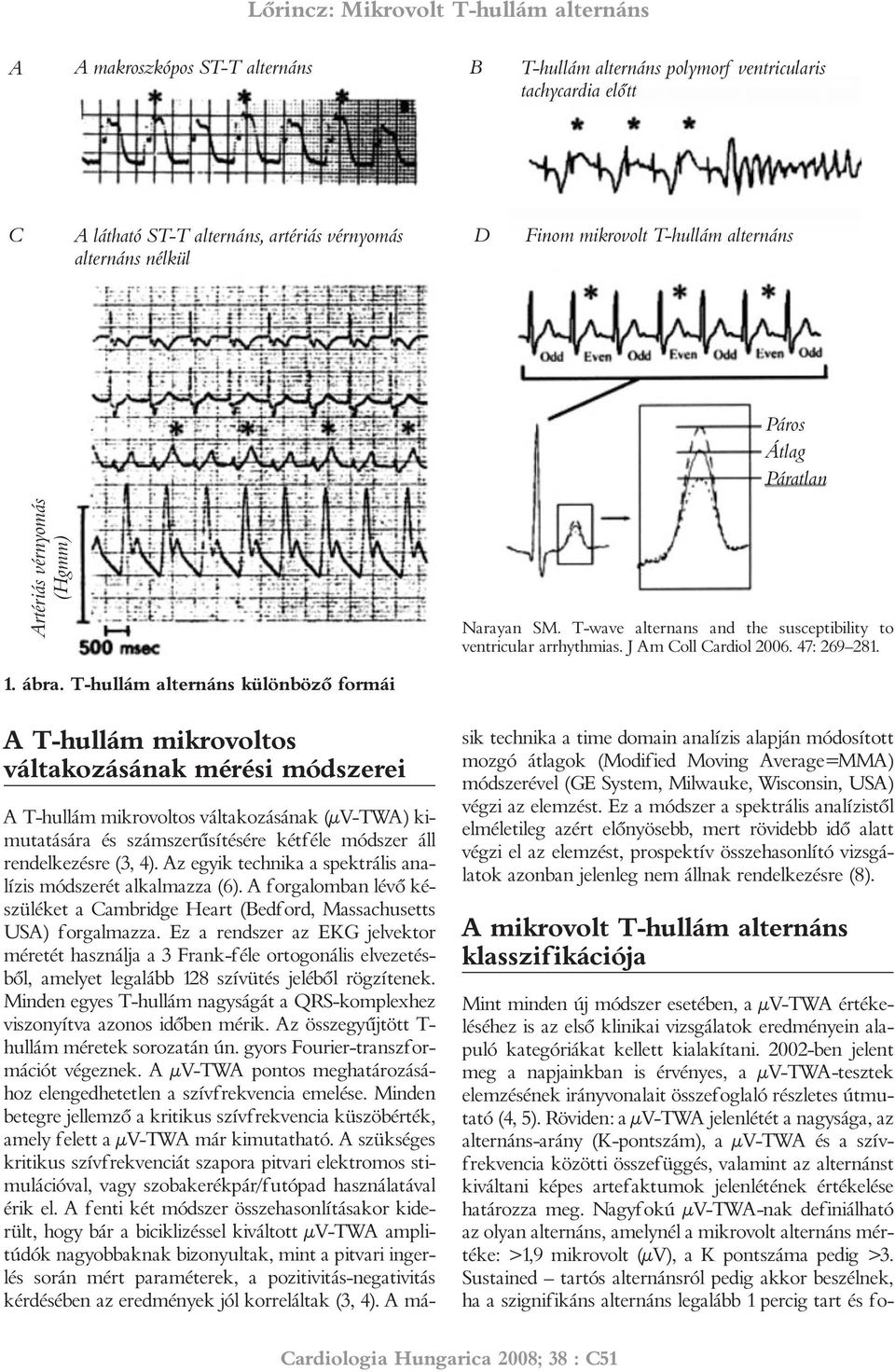 T-hullám alternáns különbözõ formái A T-hullám mikrovoltos váltakozásának mérési módszerei A T-hullám mikrovoltos váltakozásának (µv-twa) kimutatására és számszerûsítésére kétféle módszer áll