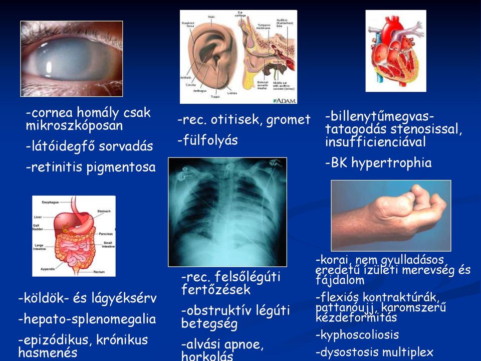 lágyéksérv -hepato-splenomegalia -epizódikus, krónikus hasmenés -rec.