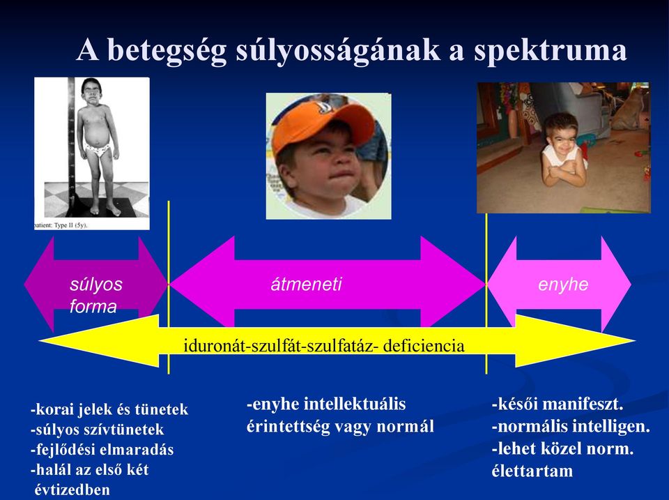 szívtünetek -fejlődési elmaradás -halál az első két évtizedben -enyhe