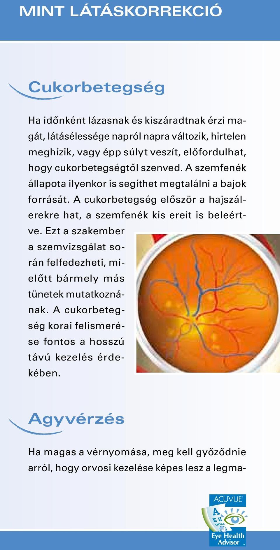 A cukorbetegség először a hajszálerekre hat, a szemfenék kis ereit is beleértve.