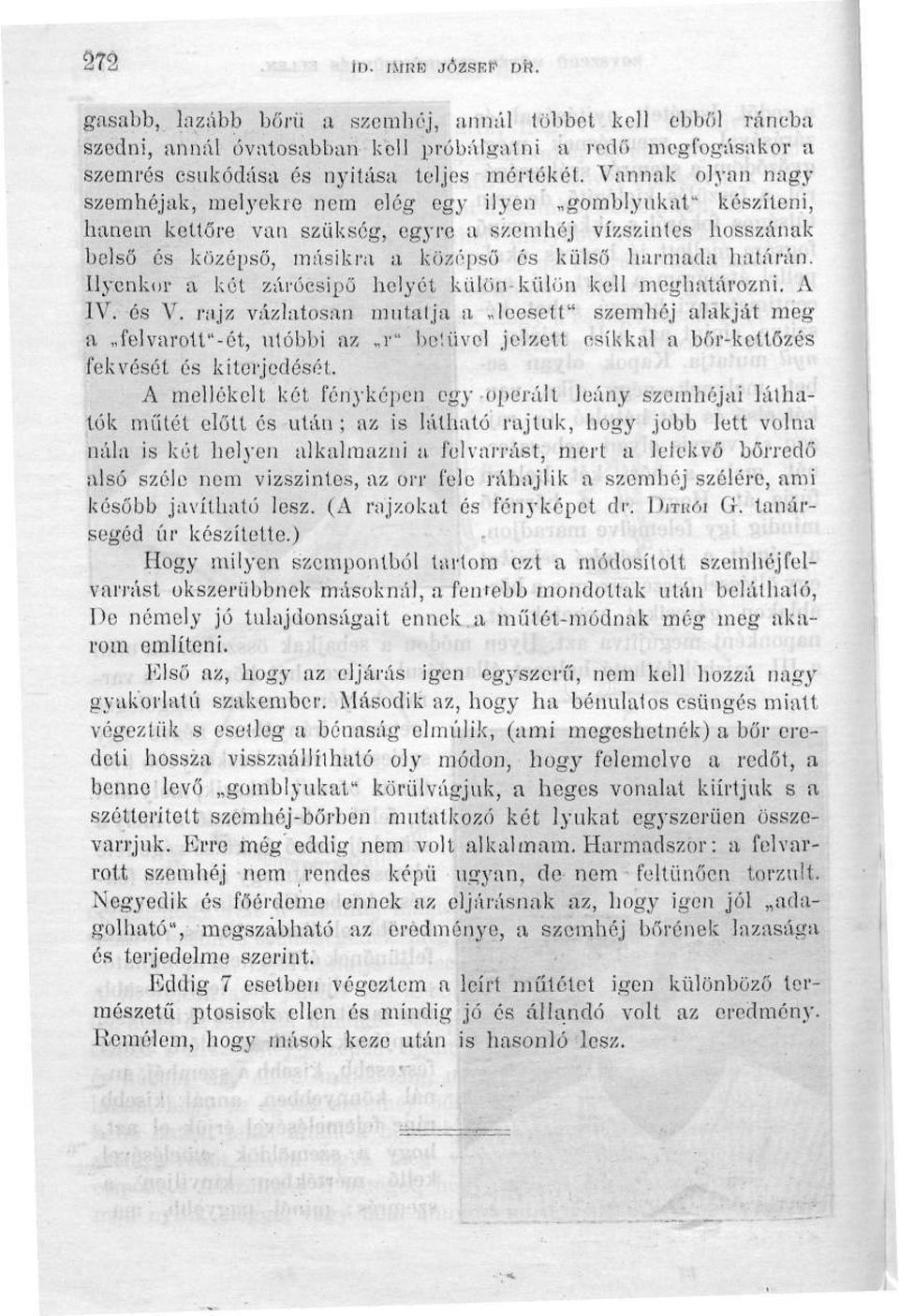 határán. Ilyenkor a két zárócsipő helyét külön-külön kell meghatározni. A IV". és V.