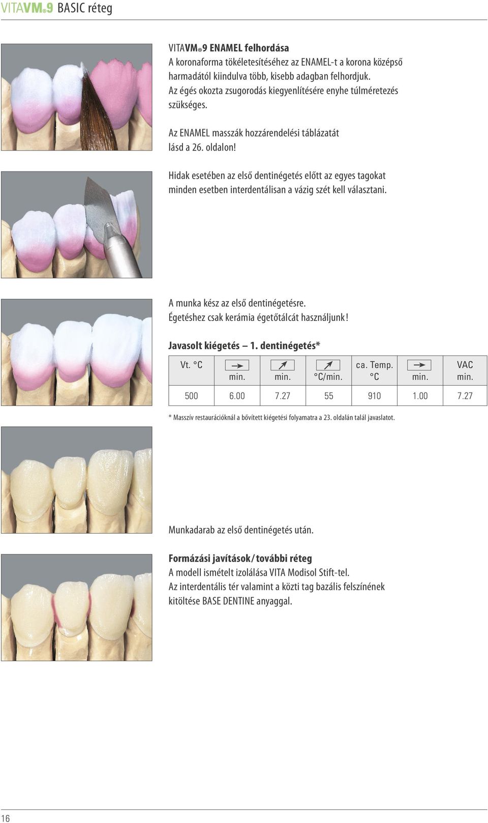 Hidak esetében az első dentinégetés előtt az egyes tagokat minden esetben interdentálisan a vázig szét kell választani. A munka kész az első dentinégetésre.