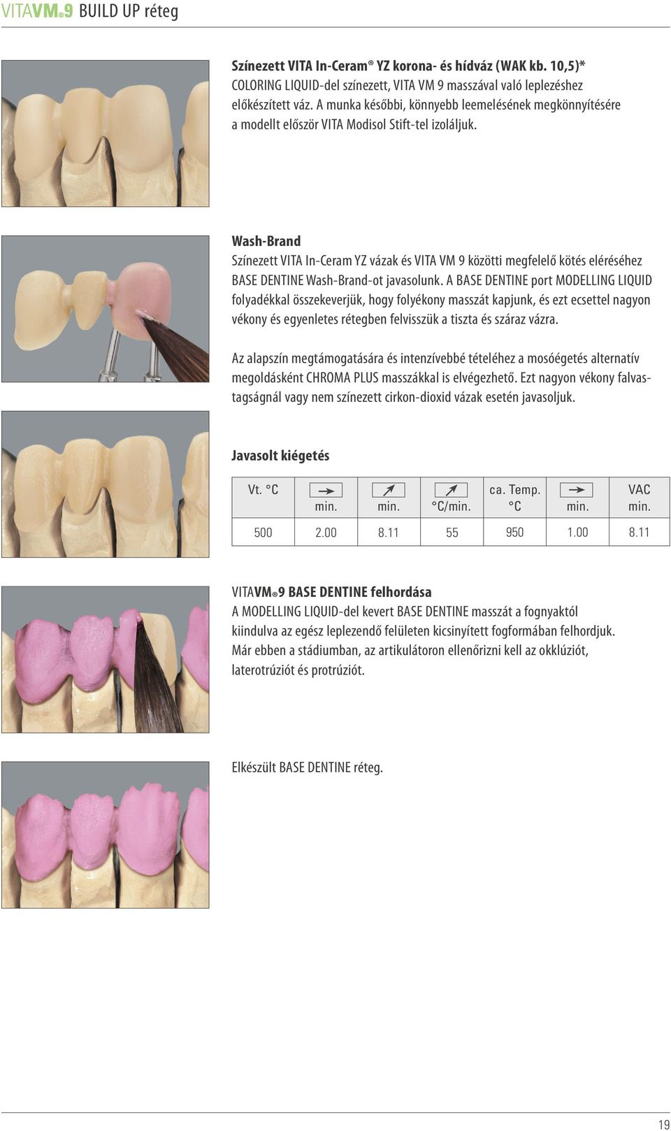 Wash-Brand Színezett VITA In-Ceram YZ vázak és VITA VM 9 közötti megfelelő kötés eléréséhez BASE DENTINE Wash-Brand-ot javasolunk.