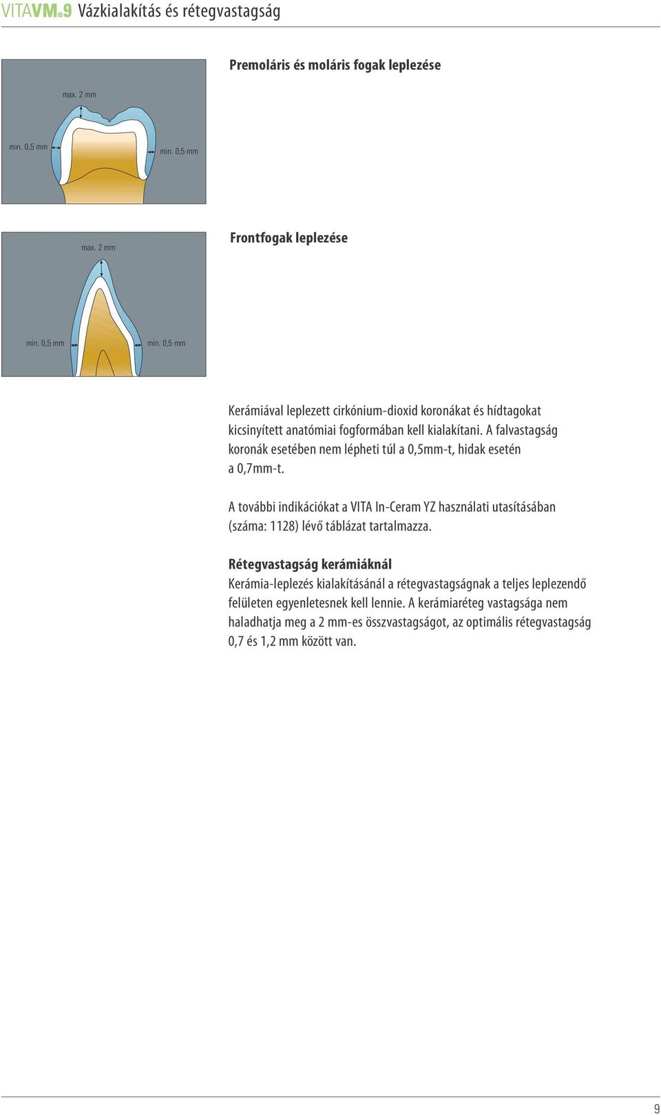 A falvastagság koronák esetében nem lépheti túl a 0,5mm-t, hidak esetén a 0,7mm-t.