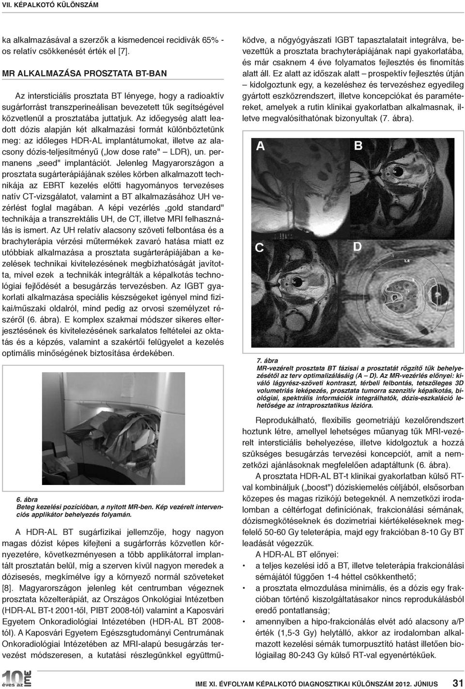 Az időegység alatt leadott dózis alapján két alkalmazási formát különböztetünk meg: az időleges HDR-AL implantátumokat, illetve az alacsony dózis-teljesítményű ( low dose rate" LDR), un.