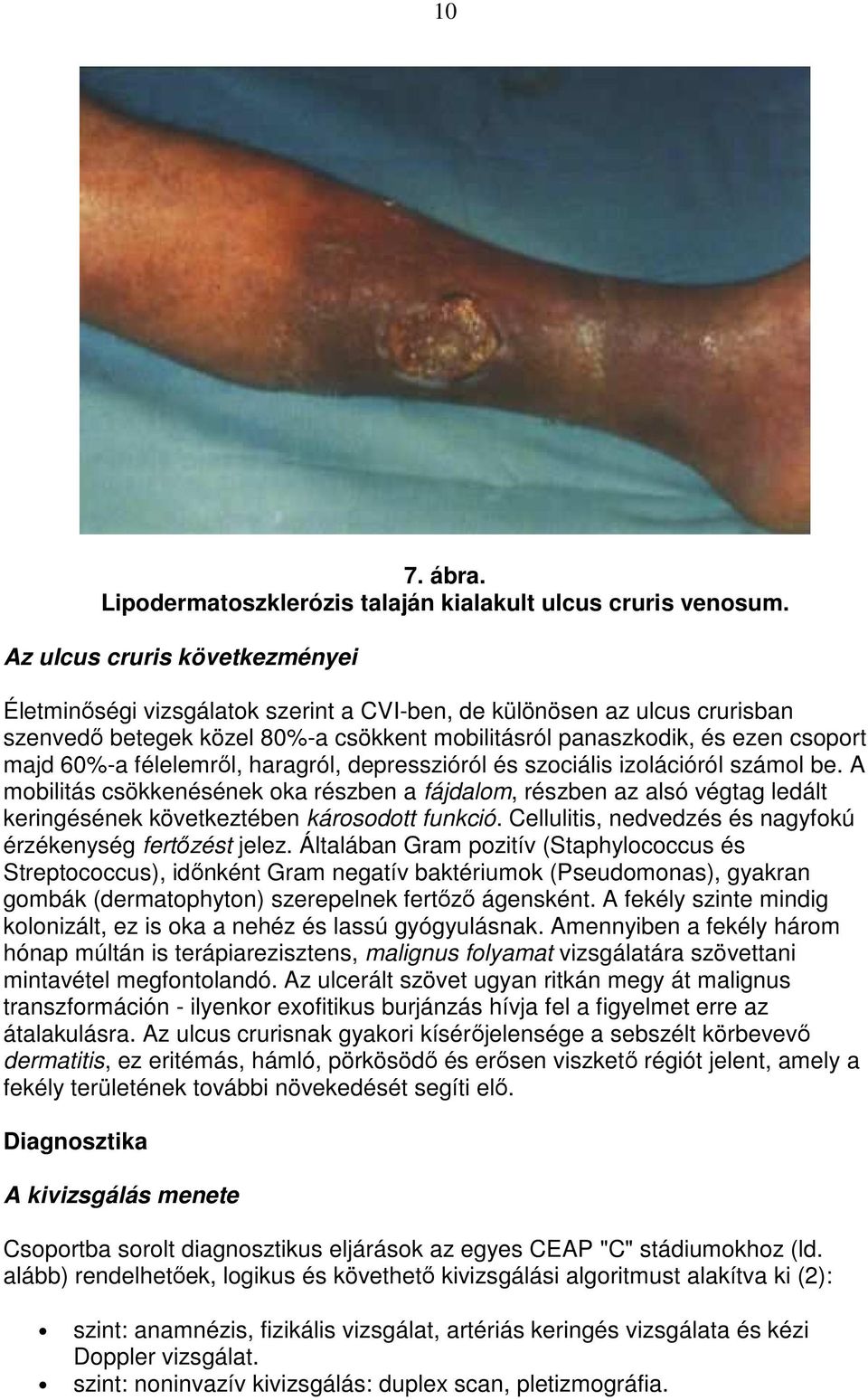 félelemrıl, haragról, depresszióról és szociális izolációról számol be. A mobilitás csökkenésének oka részben a fájdalom, részben az alsó végtag ledált keringésének következtében károsodott funkció.