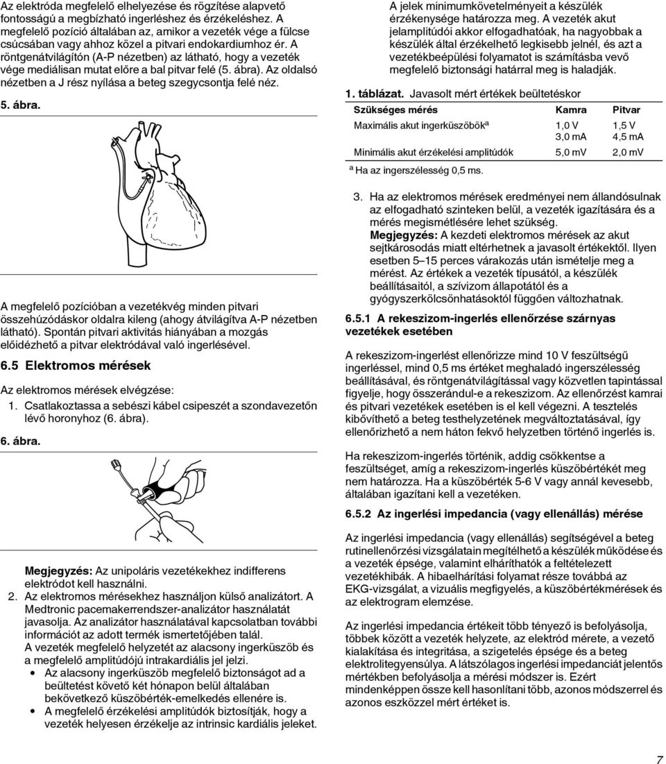 A röntgenátvilágítón (A-P nézetben) az látható, hogy a vezeték vége mediálisan mutat előre a bal pitvar felé (5. ábra)