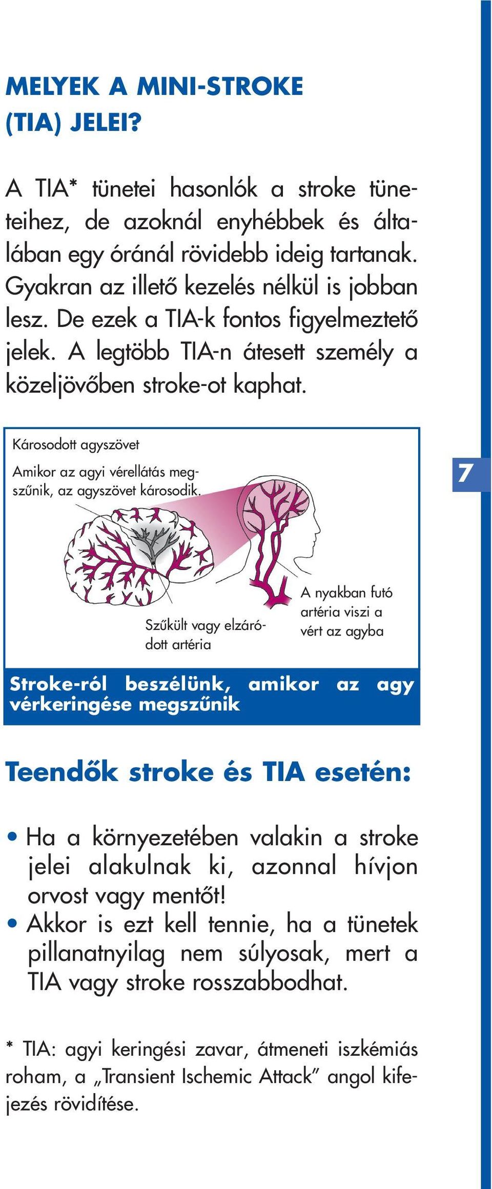 7 Szûkült vagy elzáródott artéria A nyakban futó artéria viszi a vért az agyba Stroke-ról beszélünk, amikor az agy vérkeringése megszûnik Teendôk stroke és TIA esetén: Ha a környezetében valakin a