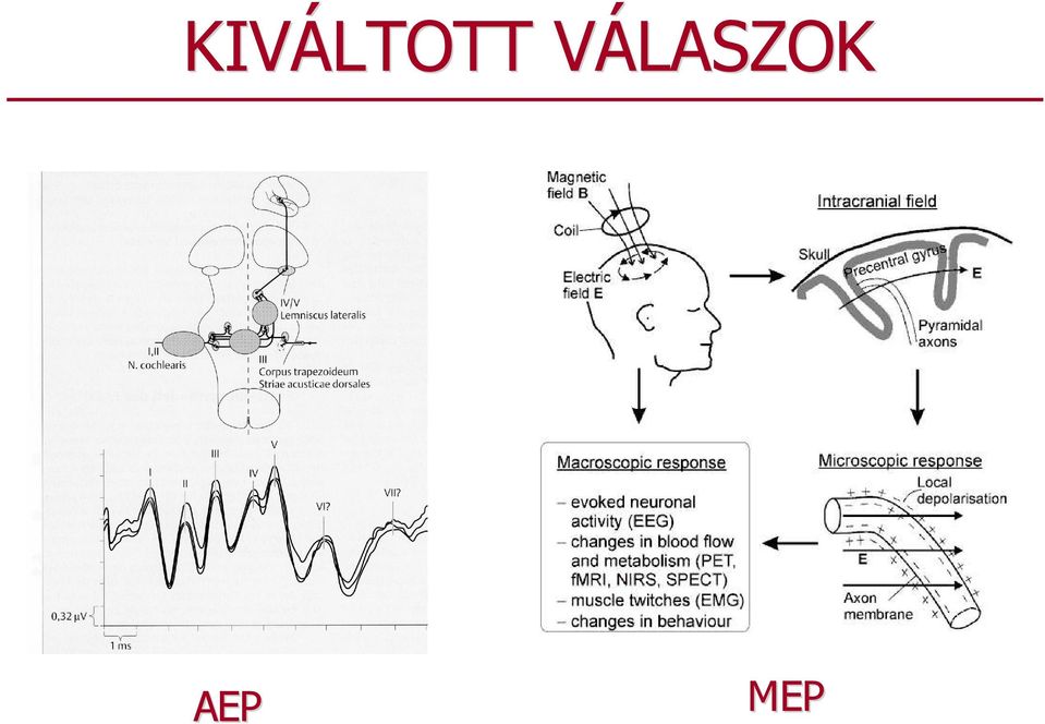 AEP MEP