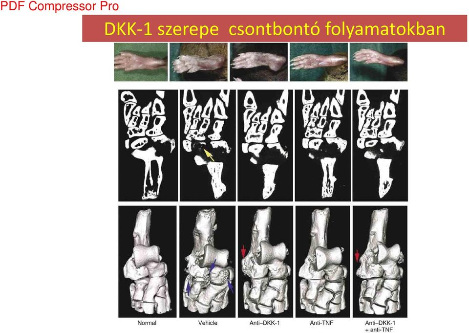 Dickkopf-1 is a master regulator