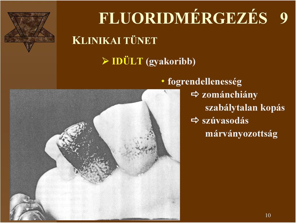 zománchiány szabálytalan kopás