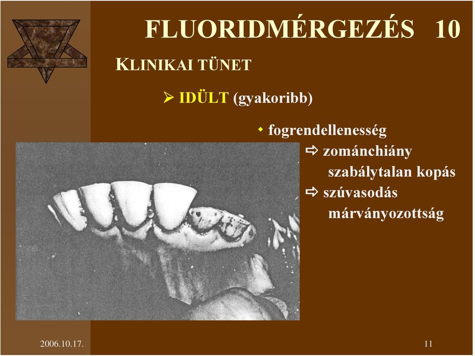 zománchiány szabálytalan kopás