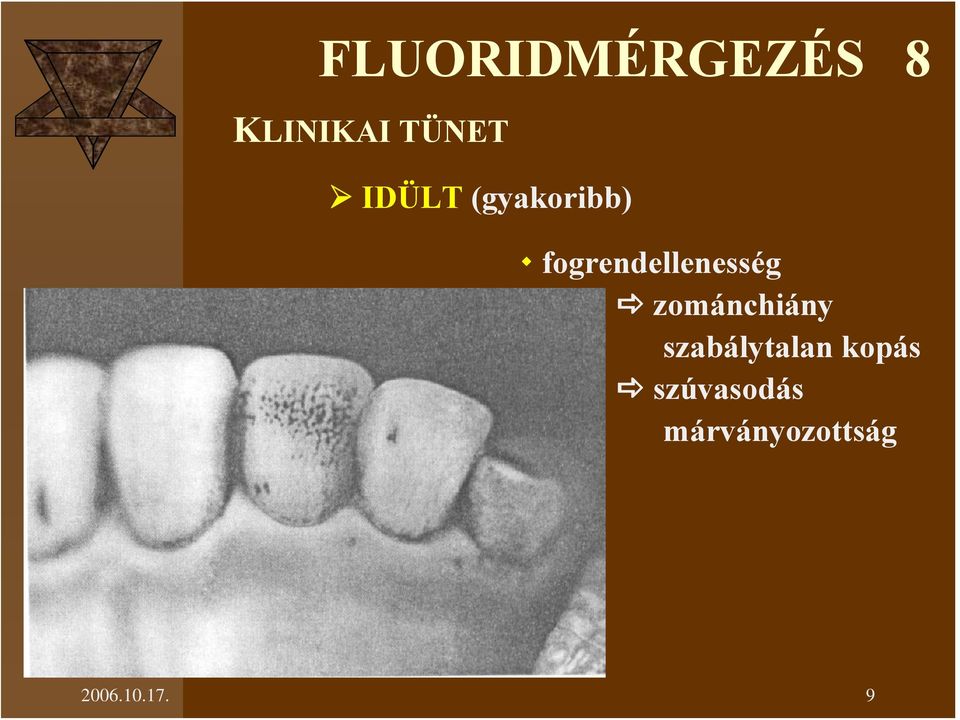 fogrendellenesség zománchiány