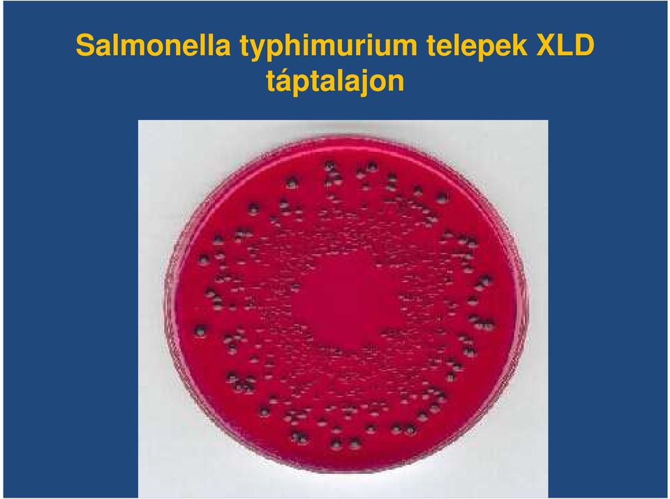 telepek XLD