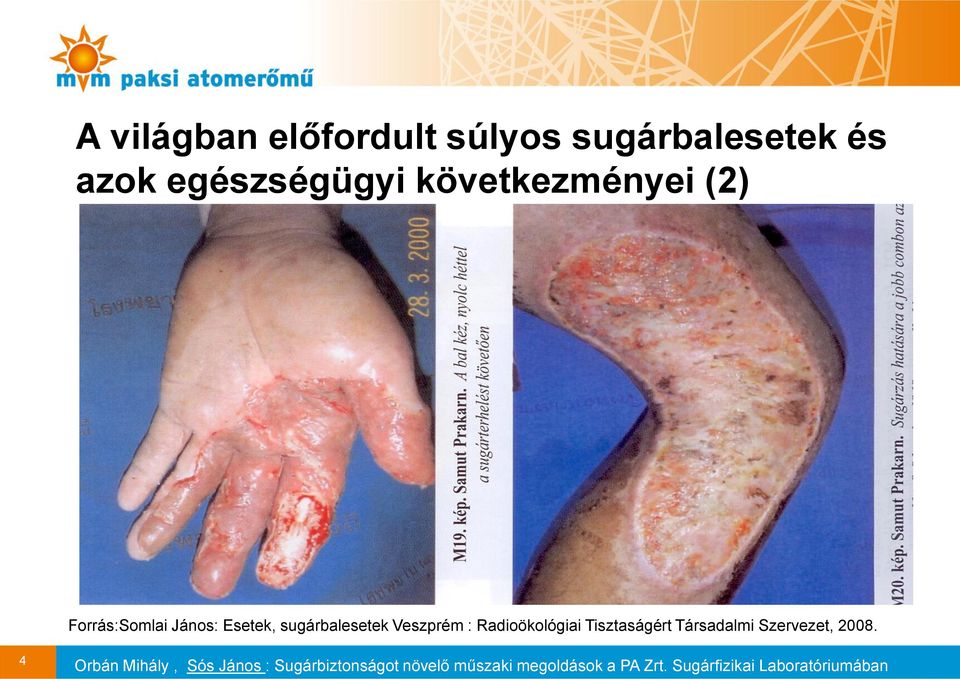 Forrás:Somlai János: Esetek, sugárbalesetek