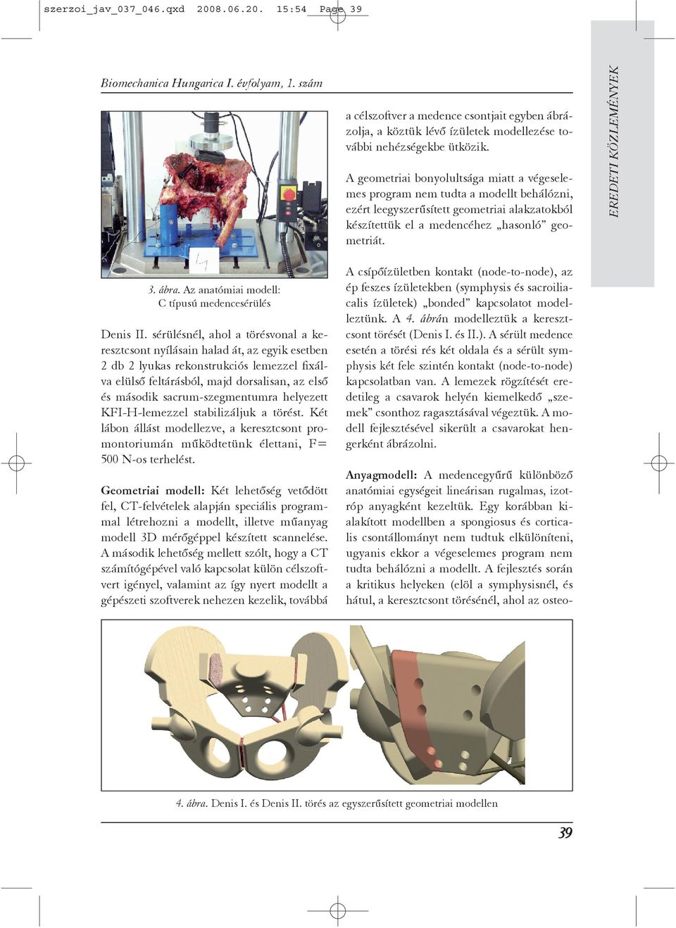 Az anatómiai modell: C típusú medencesérülés Denis II.