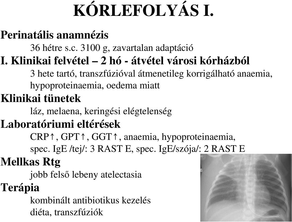 hypoproteinaemia, oedema miatt Klinikai tünetek láz, melaena, keringési elégtelenség Laboratóriumi eltérések CRP, GPT, GGT,