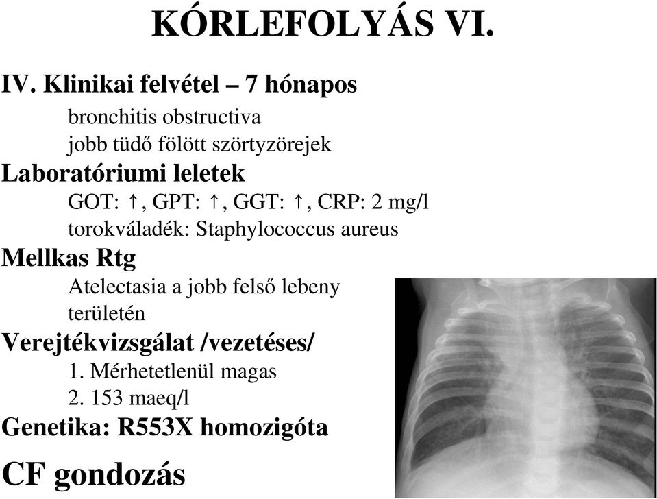 Laboratóriumi leletek GOT:, GPT:, GGT:, CRP: 2 mg/l torokváladék: Staphylococcus aureus