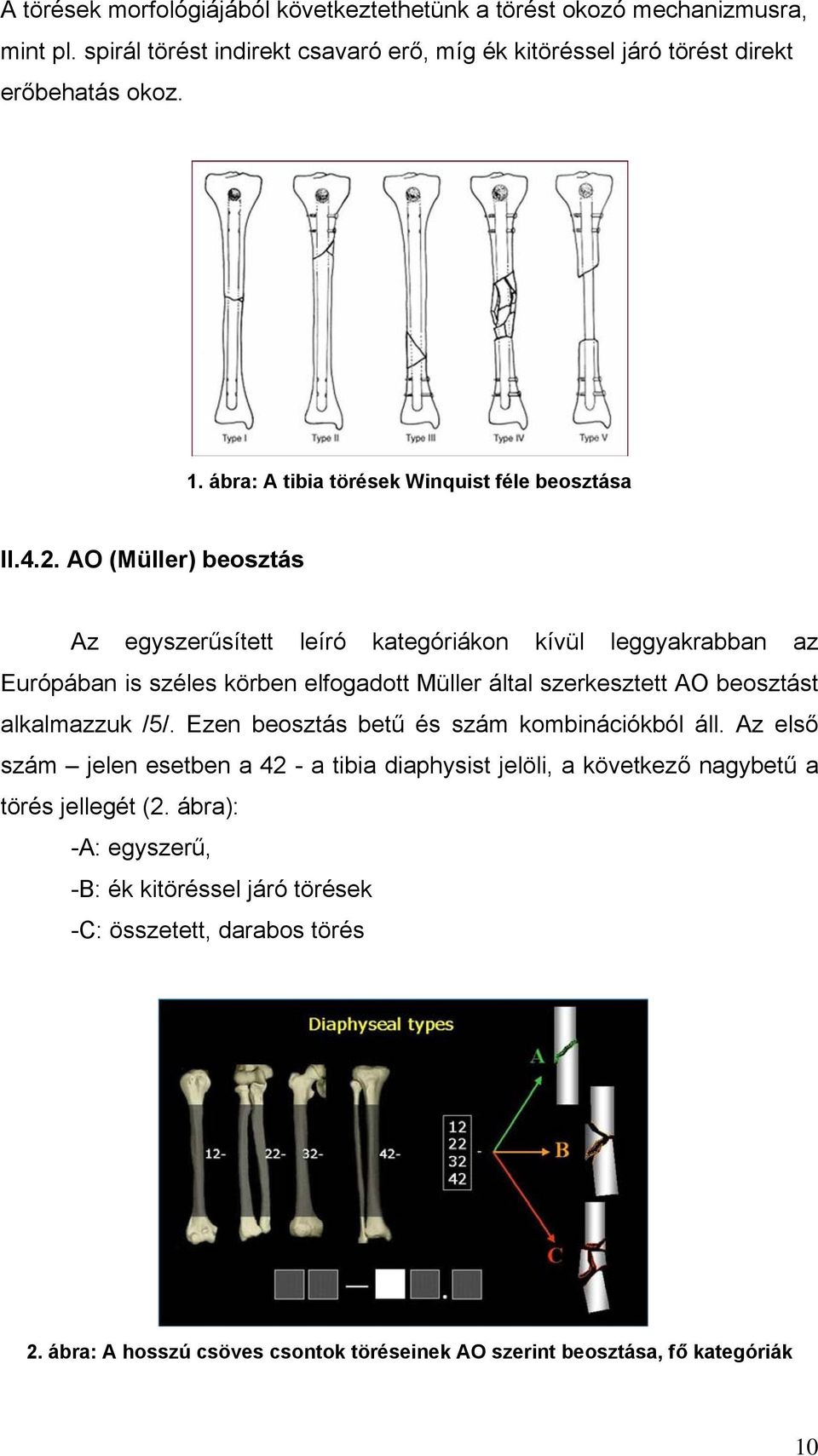 AO (Müller) beosztás Az egyszerűsített leíró kategóriákon kívül leggyakrabban az Európában is széles körben elfogadott Müller által szerkesztett AO beosztást alkalmazzuk /5/.