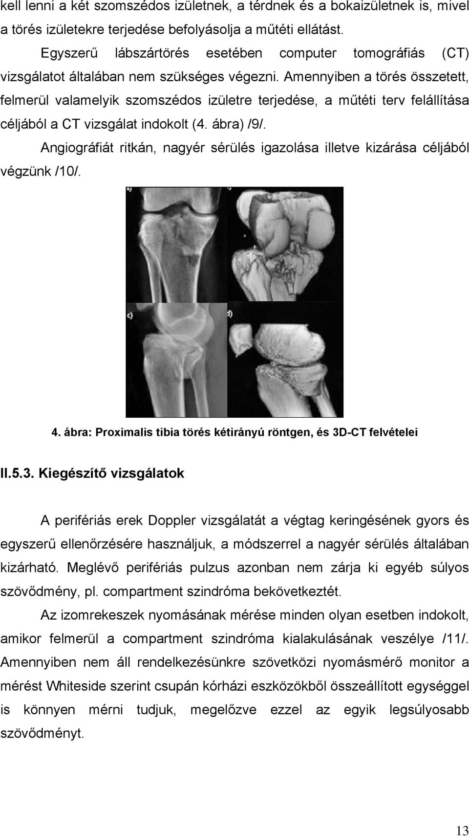 Amennyiben a törés összetett, felmerül valamelyik szomszédos izületre terjedése, a műtéti terv felállítása céljából a CT vizsgálat indokolt (4. ábra) /9/.