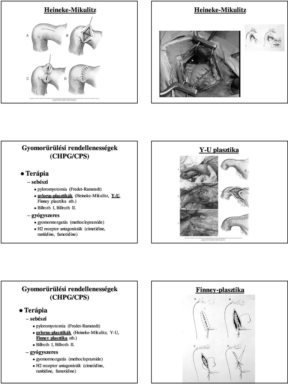 gyógyszeres gyomormozgatás (methoclopramide methoclopramide) H2 receptor antagonisták (cimetidine cimetidine, ranitidine, famotidine) Gyomorürülési rendellenességek (CHPG/CPS) sebészi