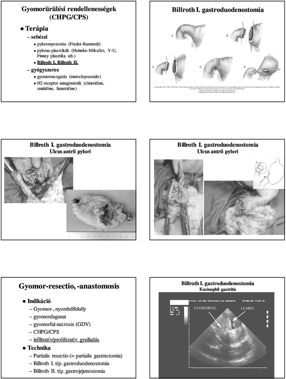 gyógyszeres gyomormozgatás (metoclopramide metoclopramide) H2 receptor antagonisták (cimetidine cimetidine, ranitidine, famotidine) Ulcus antrii pylori Ulcus antrii