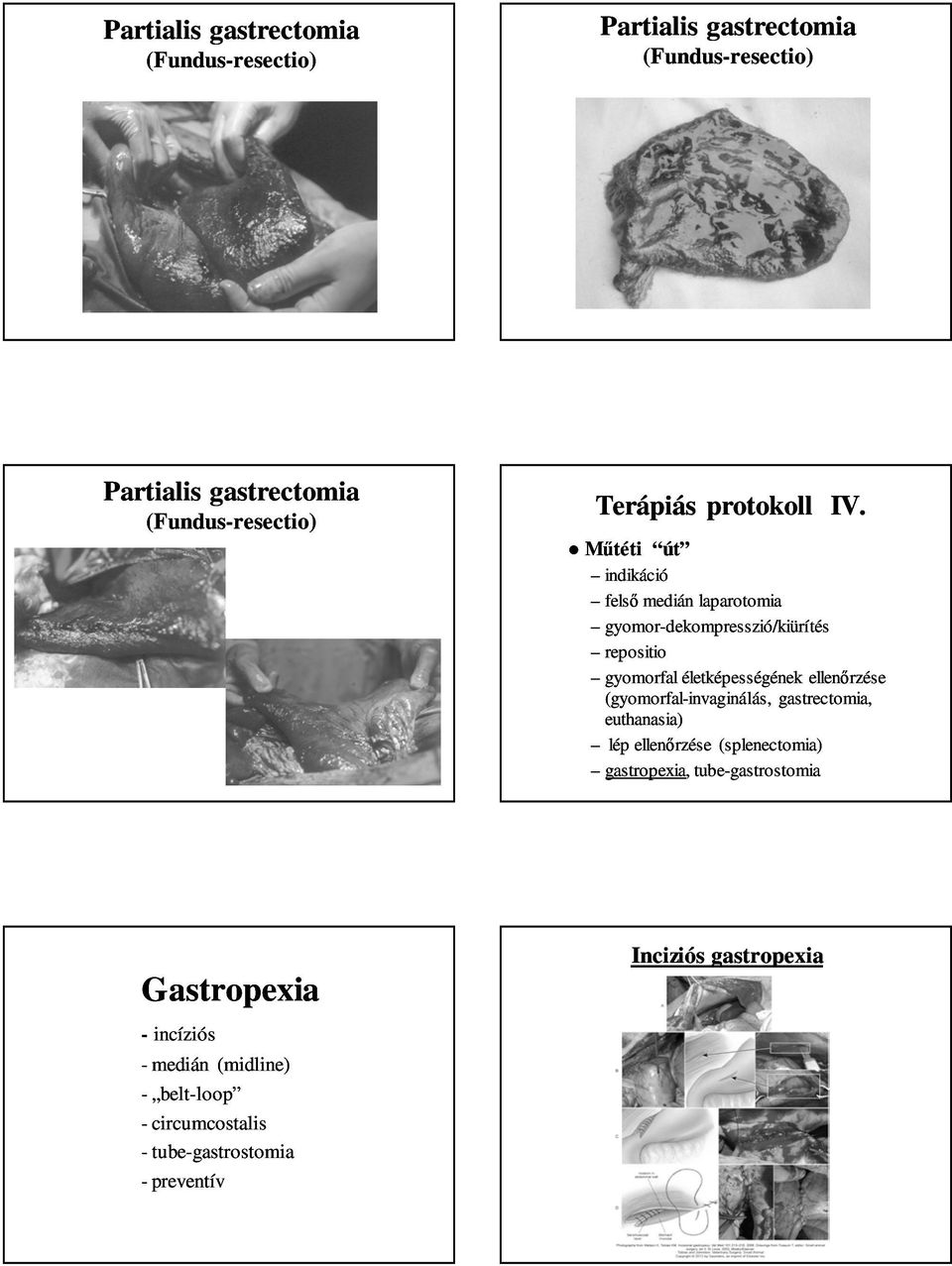 Műtéti út indikáció felső medián laparotomia gyomor-dekompresszió/kiürítés repositio gyomorfal életképességének ellenőrzése