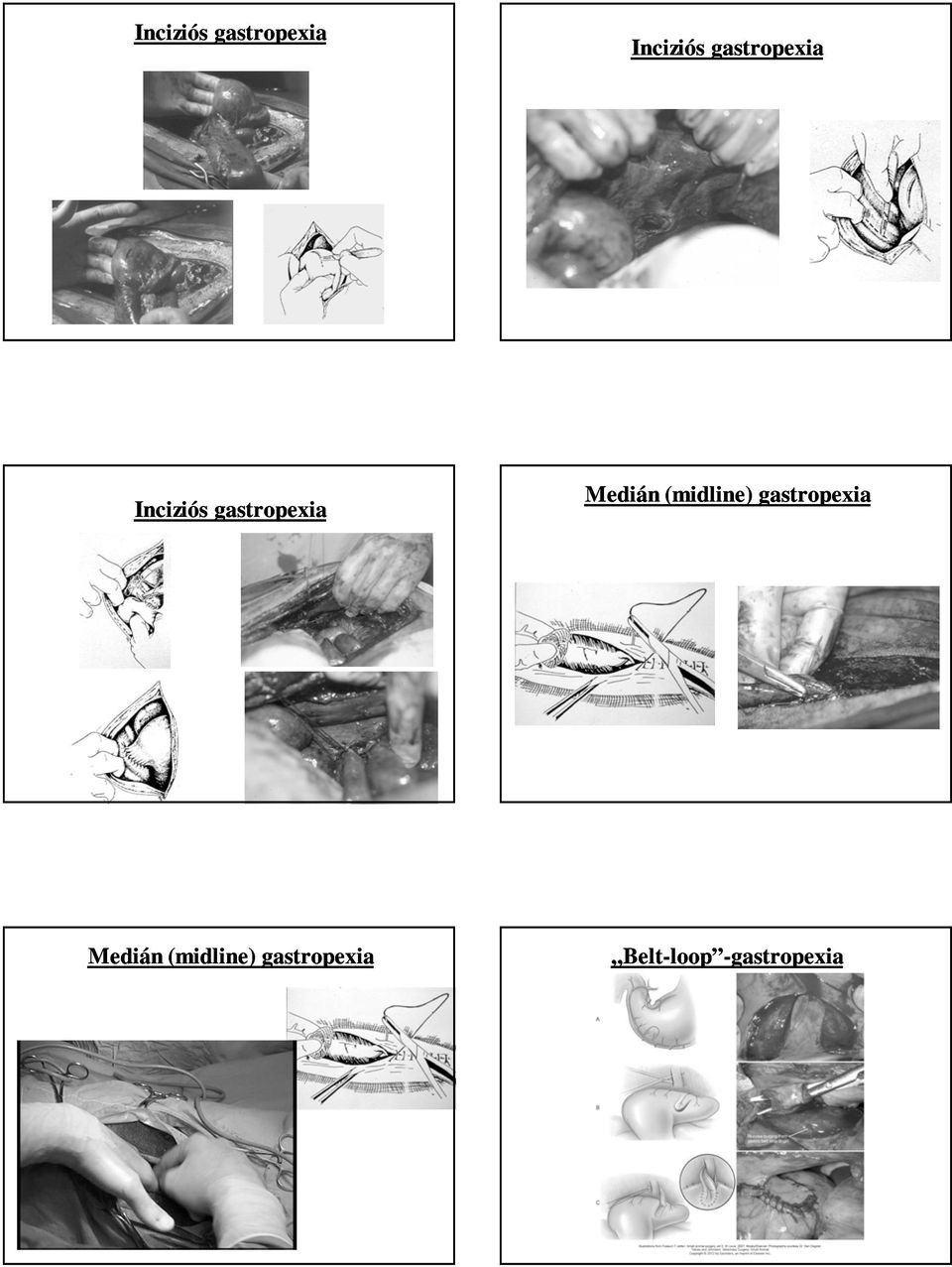 Medián (midline) gastropexia Medián