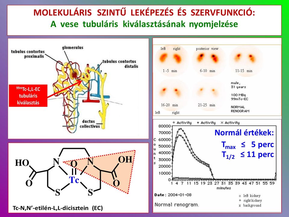 kiválasztás H 2 p-amino-hippursav H S H Tc H CH 2 C S Tc-, -etilén-l,l-dicisztein