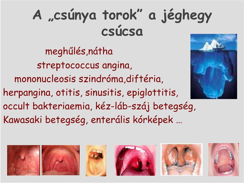 herpangina, otitis, sinusitis, epiglottitis, occult