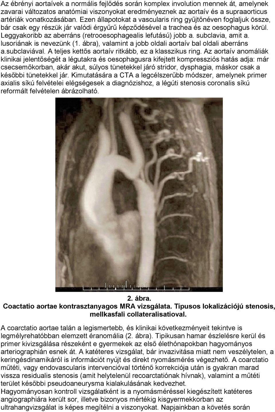 Leggyakoribb az aberráns (retrooesophagealis lefutású) jobb a. subclavia, amit a. lusoriának is nevezünk (1. ábra), valamint a jobb oldali aortaív bal oldali aberráns a.subclaviával.