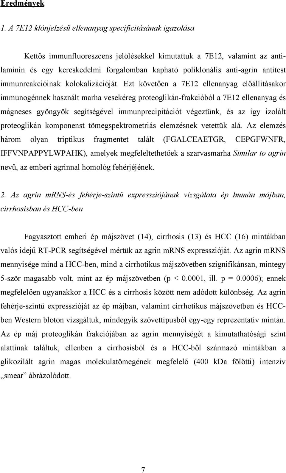 anti-agrin antitest immunreakcióinak kolokalizációját.