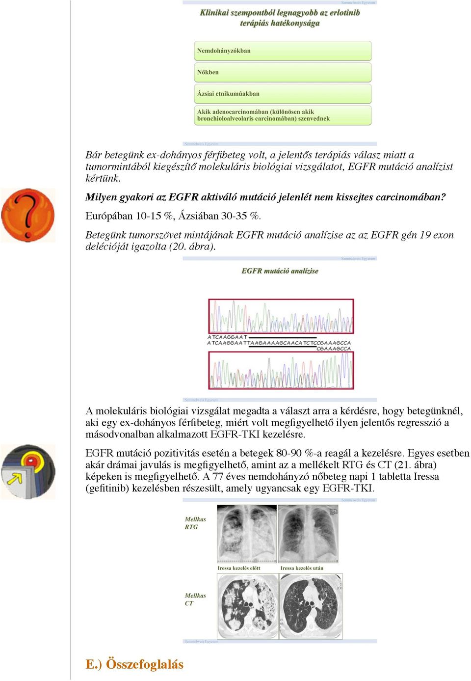 Betegünk tumorszövet mintájának EGFR mutáció analízise az az EGFR gén 19 exon delécióját igazolta (20. ábra).