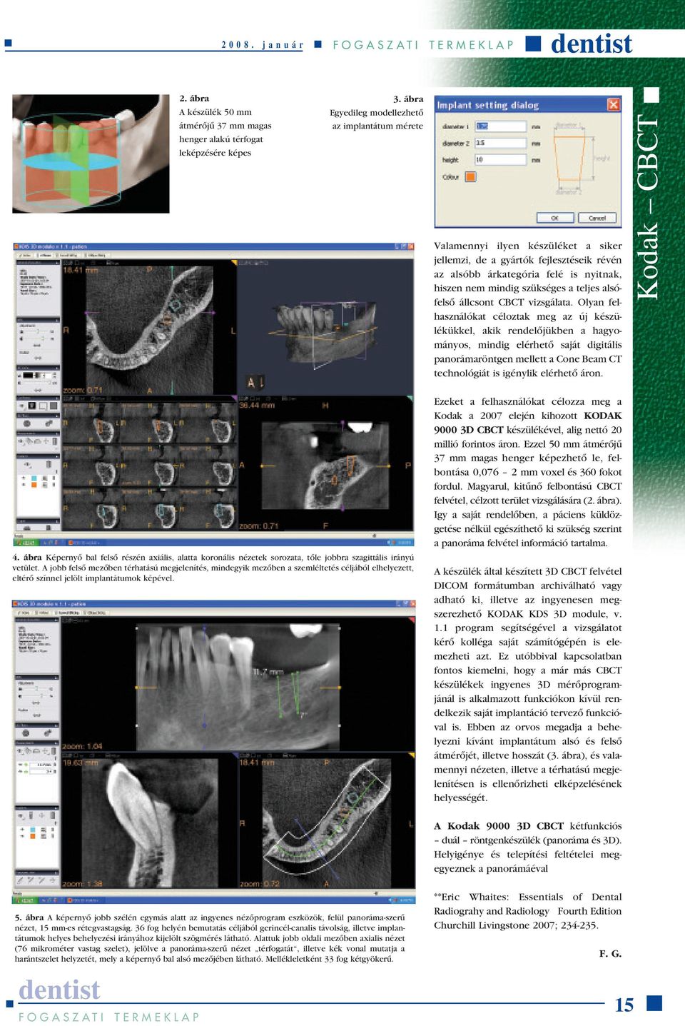 teljes alsófelsô állcsont CBCT vizsgálata.