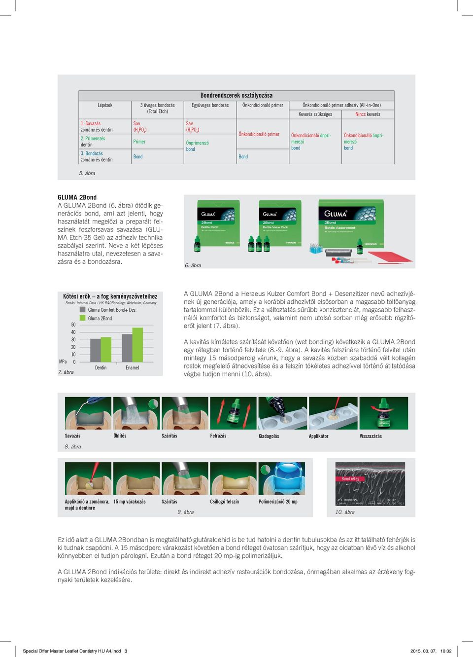 Bondozás zománc és dentin Sav (H 3 PO 4 ) Primer Bond Sav (H 3 PO 4 ) Önprimerező bond Önkondícionáló primer Bond Önkondícionáló önprimerező bond Önkondícionáló önprimerező bond 5.