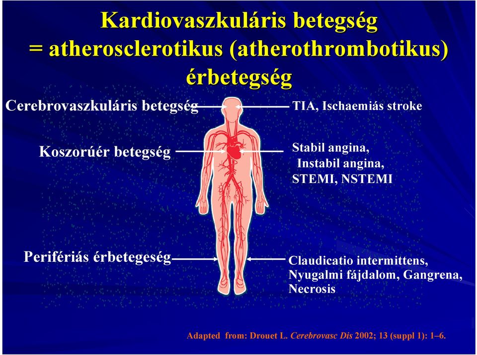 Instabil angina, STEMI, NSTEMI Perifériás érbetegeség Claudicatio intermittens,