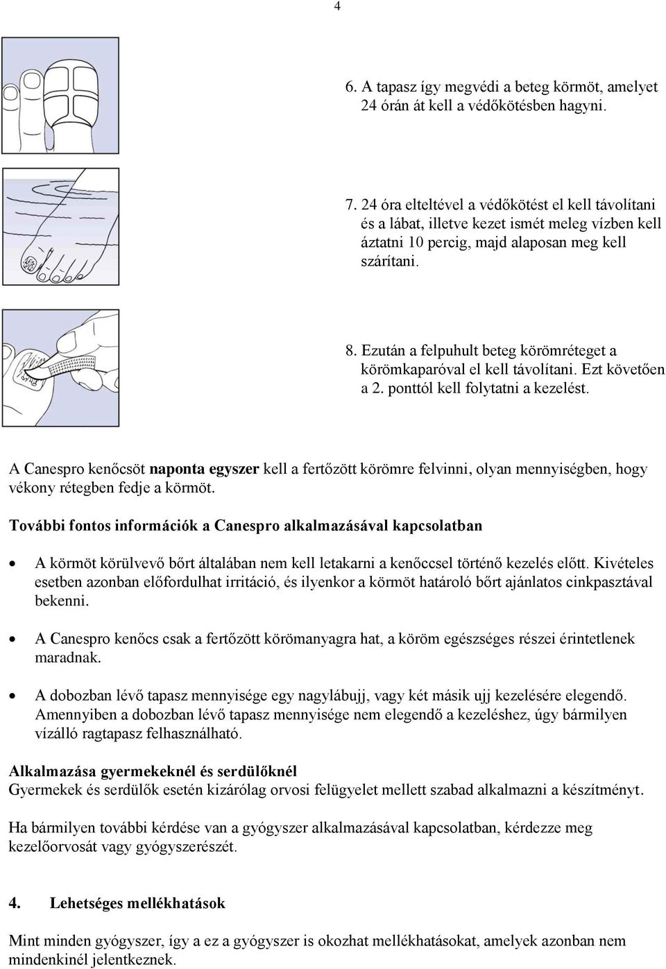 Ezután a felpuhult beteg körömréteget a körömkaparóval el kell távolítani. Ezt követően a 2. ponttól kell folytatni a kezelést.