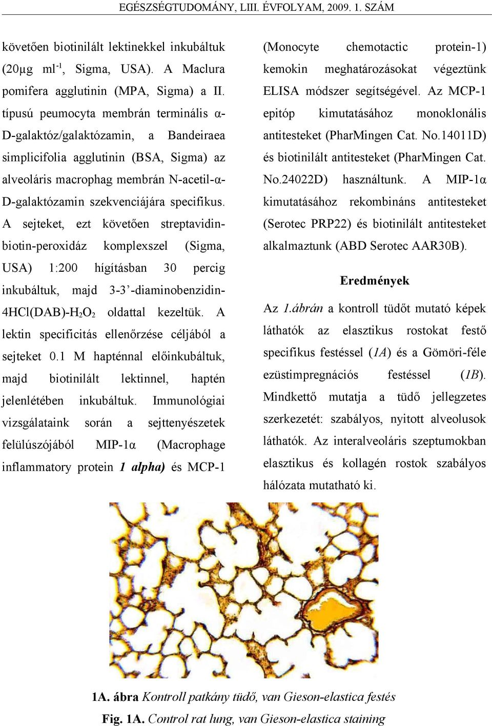 A sejteket, ezt követően streptavidinbiotin-peroxidáz komplexszel (Sigma, USA) 1:200 hígításban 30 percig inkubáltuk, majd 3-3 -diaminobenzidin- 4HCl(DAB)-H 2 O 2 oldattal kezeltük.