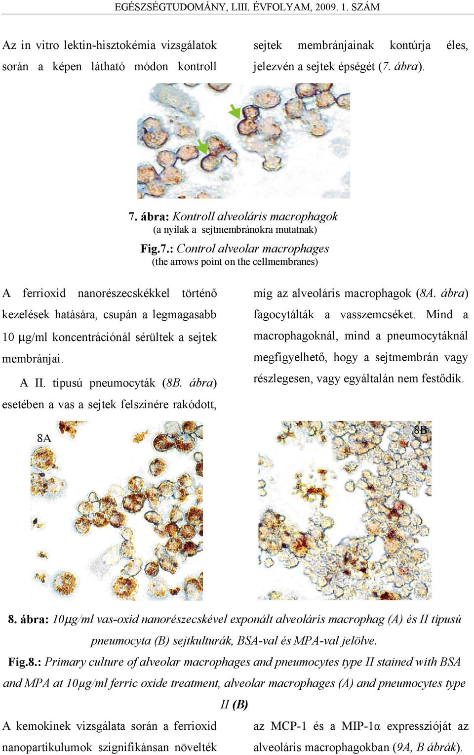 : Control alveolar macrophages (the arrows point on the cellmembranes) A ferrioxid nanorészecskékkel történő kezelések hatására, csupán a legmagasabb 10 µg/ml koncentrációnál sérültek a sejtek