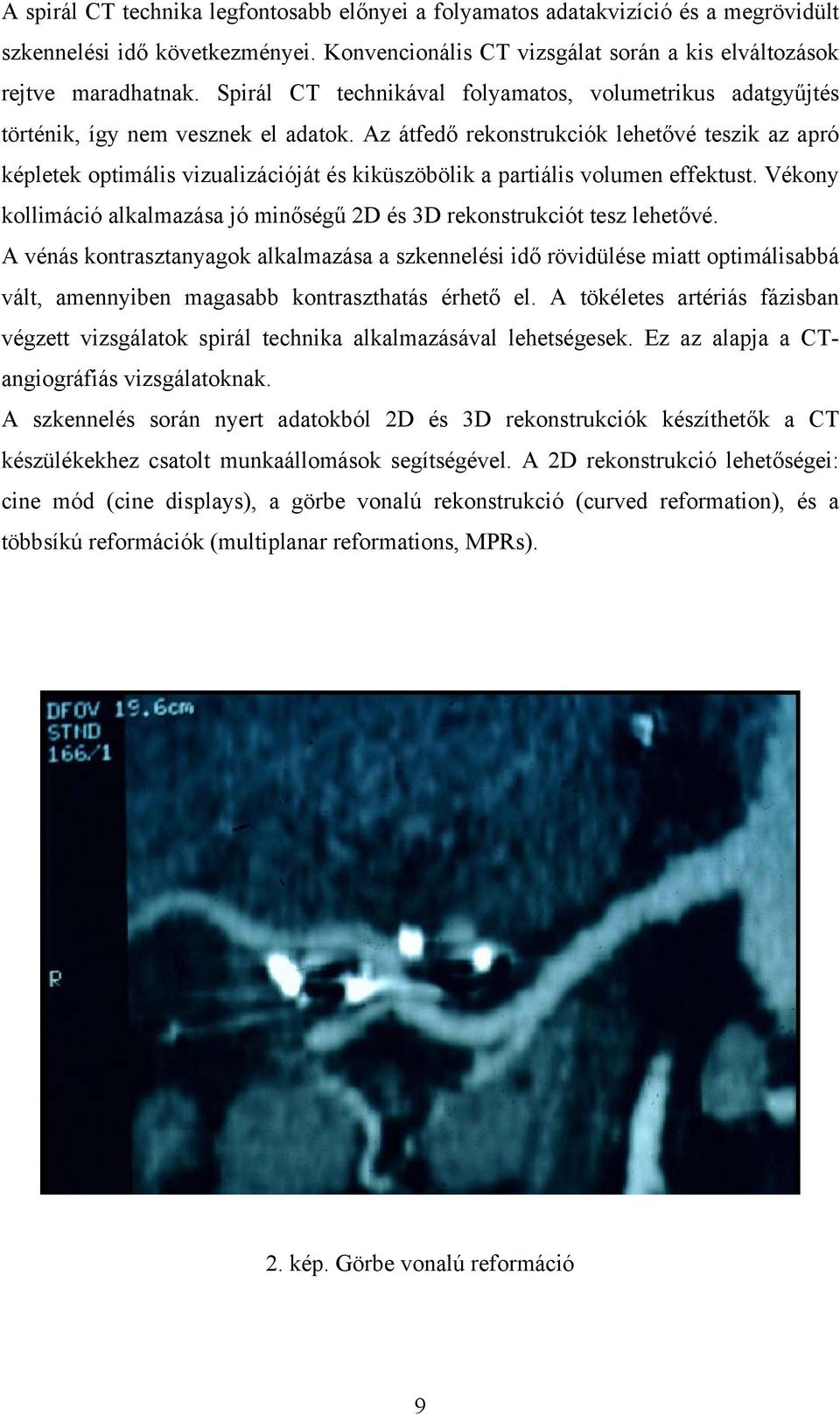 Az átfedő rekonstrukciók lehetővé teszik az apró képletek optimális vizualizációját és kiküszöbölik a partiális volumen effektust.